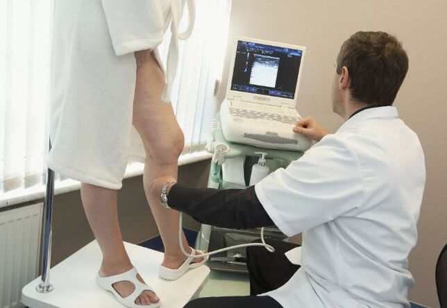 A varikoosák diagnosztizálása